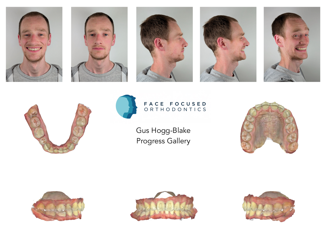 Face Focused Progress Gallery
